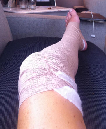 Recovery